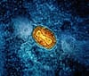 What We Know About Mpox